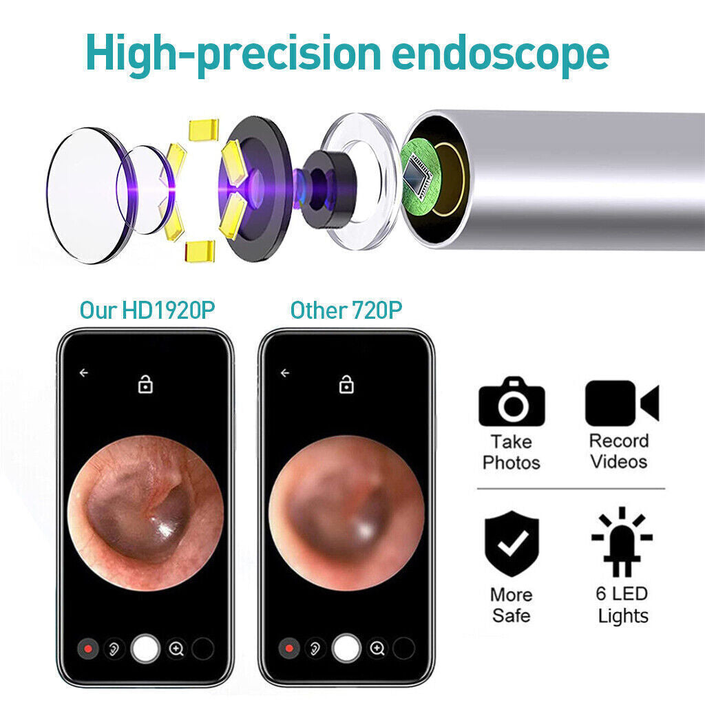 Wireless Ear Wax Remover, Camera HD Ear Endoscope Spoon Pick Cleaning Tools Kit